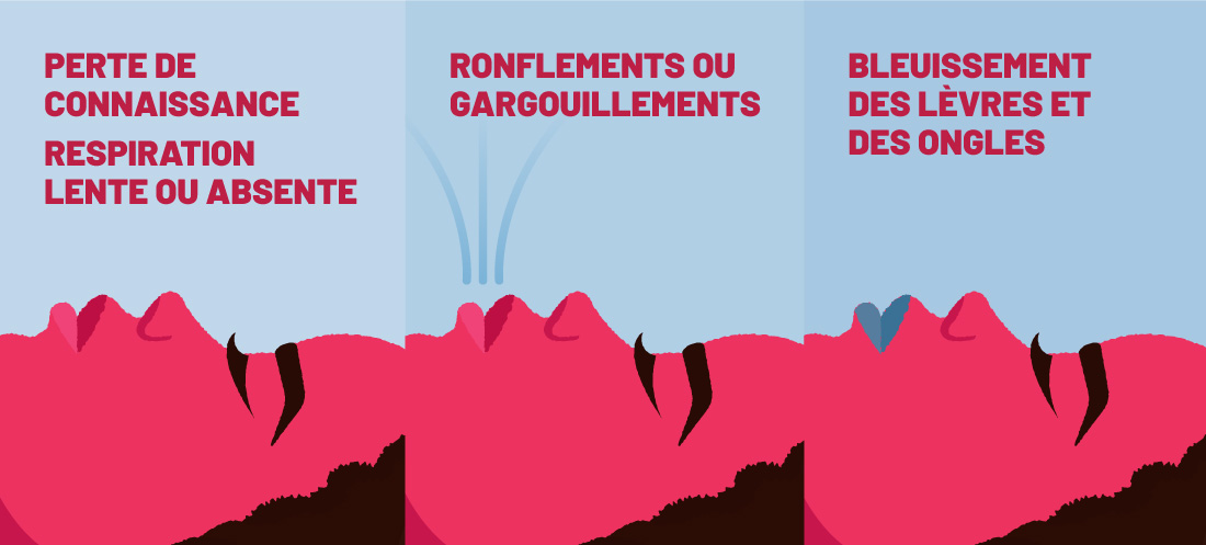 Illustration de quelques symptômes d’une surdose : Perte de connaissance 
Respiration lente ou absente 
Ronflements ou gargouillements 
Bleuissement des lèvres et des ongles 